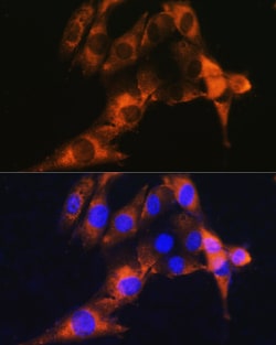 Invitrogen CD13 Polyclonal Antibody 100 &mu;L; Unconjugated:Antibodies,