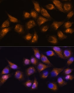 Invitrogen CD13 Polyclonal Antibody 100 &mu;L; Unconjugated:Antibodies,