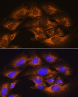Invitrogen CD13 Polyclonal Antibody 100 &mu;L; Unconjugated:Antibodies,