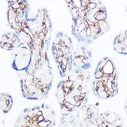 Invitrogen CD13 Polyclonal Antibody 100 &mu;L; Unconjugated:Antibodies,