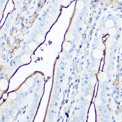 Invitrogen CD13 Polyclonal Antibody 100 &mu;L; Unconjugated:Antibodies,