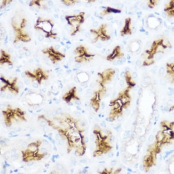 Invitrogen CD13 Polyclonal Antibody 100 &mu;L; Unconjugated:Antibodies,
