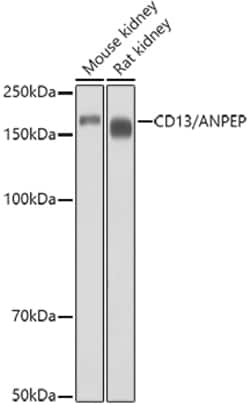 Invitrogen CD13 Polyclonal Antibody 100 &mu;L; Unconjugated:Antibodies,