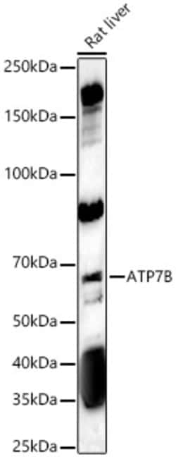 Invitrogen ATP7B Polyclonal Antibody 100 &mu;L; Unconjugated:Antibodies,