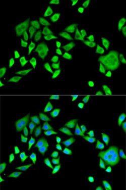 Invitrogen SH3GL2 Polyclonal Antibody 100 &mu;L; Unconjugated:Antibodies,