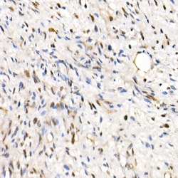 Invitrogen SMARCB1 Polyclonal Antibody 100 &mu;L; Unconjugated:Antibodies,