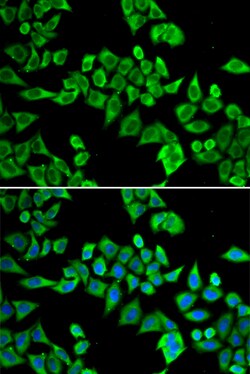 Invitrogen Gemin 3 Polyclonal Antibody 100 &mu;L; Unconjugated:Antibodies,