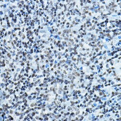 Invitrogen MYST2 Polyclonal Antibody 100 μL; Unconjugated:Antibodies,