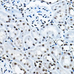 Invitrogen MYST2 Polyclonal Antibody 100 μL; Unconjugated:Antibodies,