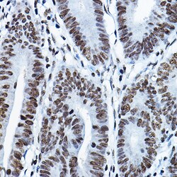 Invitrogen MYST2 Polyclonal Antibody 100 μL; Unconjugated:Antibodies,