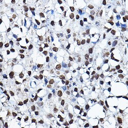 Invitrogen MYST2 Polyclonal Antibody 100 μL; Unconjugated:Antibodies,