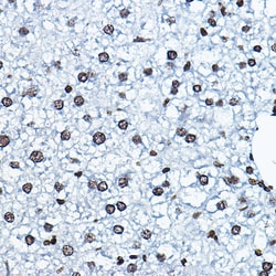 Invitrogen MYST2 Polyclonal Antibody 100 μL; Unconjugated:Antibodies,