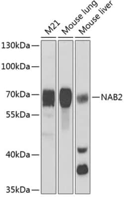 Invitrogen NAB2 Polyclonal Antibody 100 &mu;L | Buy Online | Invitrogen&trade; | Fisher Scientific