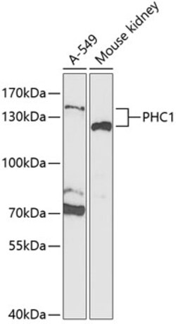 Invitrogen PHC1 Polyclonal Antibody 100 &mu;L; Unconjugated:Antibodies,
