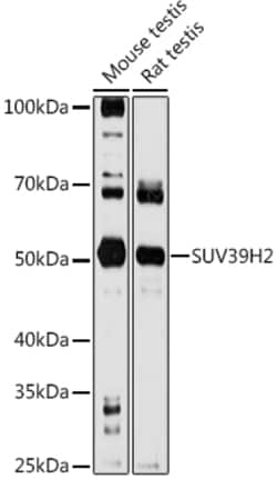Invitrogen SUV39H2 Polyclonal Antibody 100 &mu;L; Unconjugated:Antibodies,