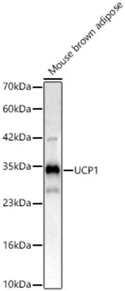 Invitrogen UCP1 Polyclonal Antibody 100 &mu;L | Buy Online | Invitrogen&trade; | Fisher Scientific