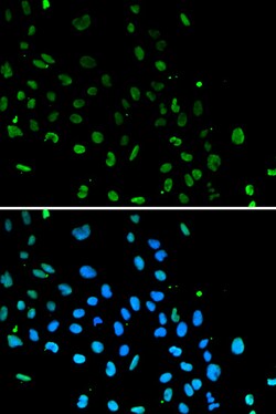Invitrogen Ku80 Polyclonal Antibody 100 &mu;L; Unconjugated:Antibodies,