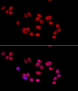 Invitrogen Ku80 Polyclonal Antibody 100 &mu;L; Unconjugated:Antibodies,