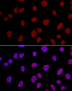 Invitrogen Ku80 Polyclonal Antibody 100 &mu;L; Unconjugated:Antibodies,