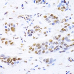 Invitrogen Ku80 Polyclonal Antibody 100 &mu;L; Unconjugated:Antibodies,