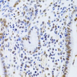 Invitrogen Ku80 Polyclonal Antibody 100 &mu;L; Unconjugated:Antibodies,