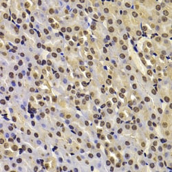 Invitrogen FBXW7 Polyclonal Antibody 100 &mu;L; Unconjugated:Antibodies,