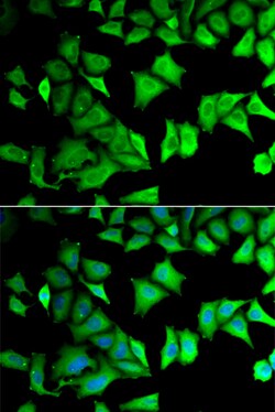Invitrogen RPS12 Polyclonal Antibody 100 &mu;L; Unconjugated:Antibodies,