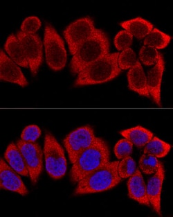 Invitrogen RPS12 Polyclonal Antibody 100 &mu;L; Unconjugated:Antibodies,
