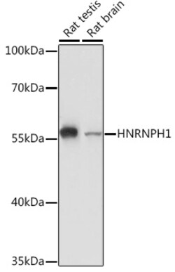 Invitrogen hnRNP H1 Polyclonal Antibody 100 &mu;L; Unconjugated:Antibodies,