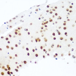 Invitrogen AGO2 Polyclonal Antibody 100 &mu;L; Unconjugated:Antibodies,