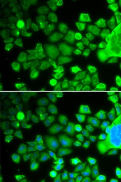 Invitrogen RPS10 Polyclonal Antibody 100 &mu;L; Unconjugated:Antibodies,