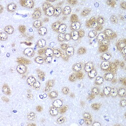 Invitrogen RPS10 Polyclonal Antibody 100 &mu;L; Unconjugated:Antibodies,