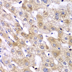 Invitrogen RPS10 Polyclonal Antibody 100 &mu;L; Unconjugated:Antibodies,