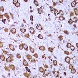 Invitrogen RPS10 Polyclonal Antibody 100 &mu;L; Unconjugated:Antibodies,