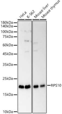 Invitrogen RPS10 Polyclonal Antibody 100 &mu;L; Unconjugated:Antibodies,