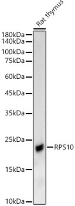 Invitrogen RPS10 Polyclonal Antibody 100 &mu;L; Unconjugated:Antibodies,