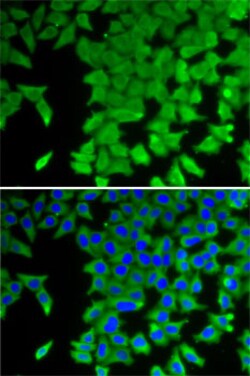 Invitrogen CRABP2 Polyclonal Antibody 100 &mu;L; Unconjugated:Antibodies,