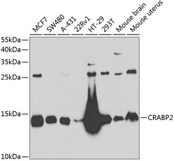 Invitrogen CRABP2 Polyclonal Antibody 100 &mu;L; Unconjugated:Antibodies,
