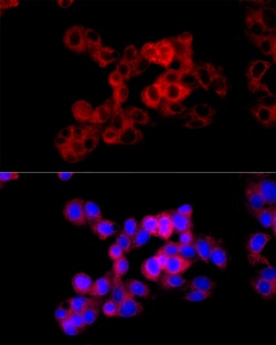 Invitrogen CTH Polyclonal Antibody 100 &mu;L; Unconjugated:Antibodies,