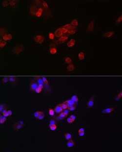 Invitrogen FGF23 Polyclonal Antibody 100 &mu;L; Unconjugated:Antibodies,