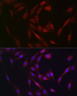 Invitrogen FGF23 Polyclonal Antibody 100 &mu;L; Unconjugated:Antibodies,