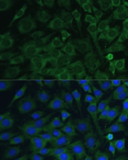 Invitrogen Oncostatin M Polyclonal Antibody 100 &mu;L; Unconjugated:Antistoffer