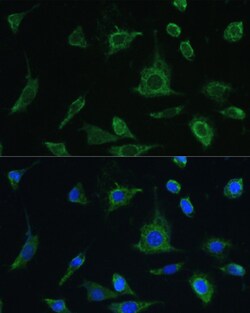 Invitrogen&trade;&nbsp;Oncostatin M Polyclonal Antibody