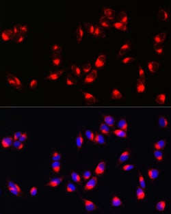 Invitrogen Melan-A Polyclonal Antibody 100 &mu;L; Unconjugated:Antibodies,