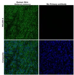 Invitrogen Melan-A Polyclonal Antibody 100 &mu;L; Unconjugated:Antibodies,