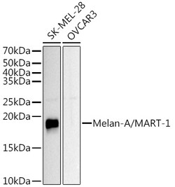 Invitrogen Melan-A Polyclonal Antibody 100 &mu;L; Unconjugated:Antibodies,