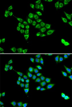 Invitrogen Pyruvate Carboxylase Polyclonal Antibody 100 μL; Unconjugated:Antibodies,