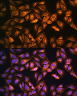 Invitrogen SOAT1 Polyclonal Antibody 100 &mu;L; Unconjugated:Antibodies,