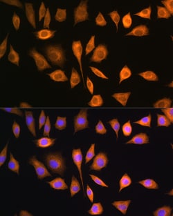 Invitrogen SOAT1 Polyclonal Antibody 100 &mu;L; Unconjugated:Antibodies,