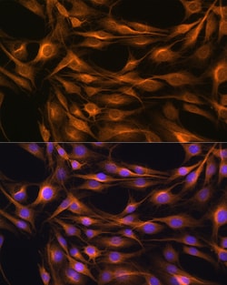 Invitrogen SOAT1 Polyclonal Antibody 100 &mu;L; Unconjugated:Antibodies,